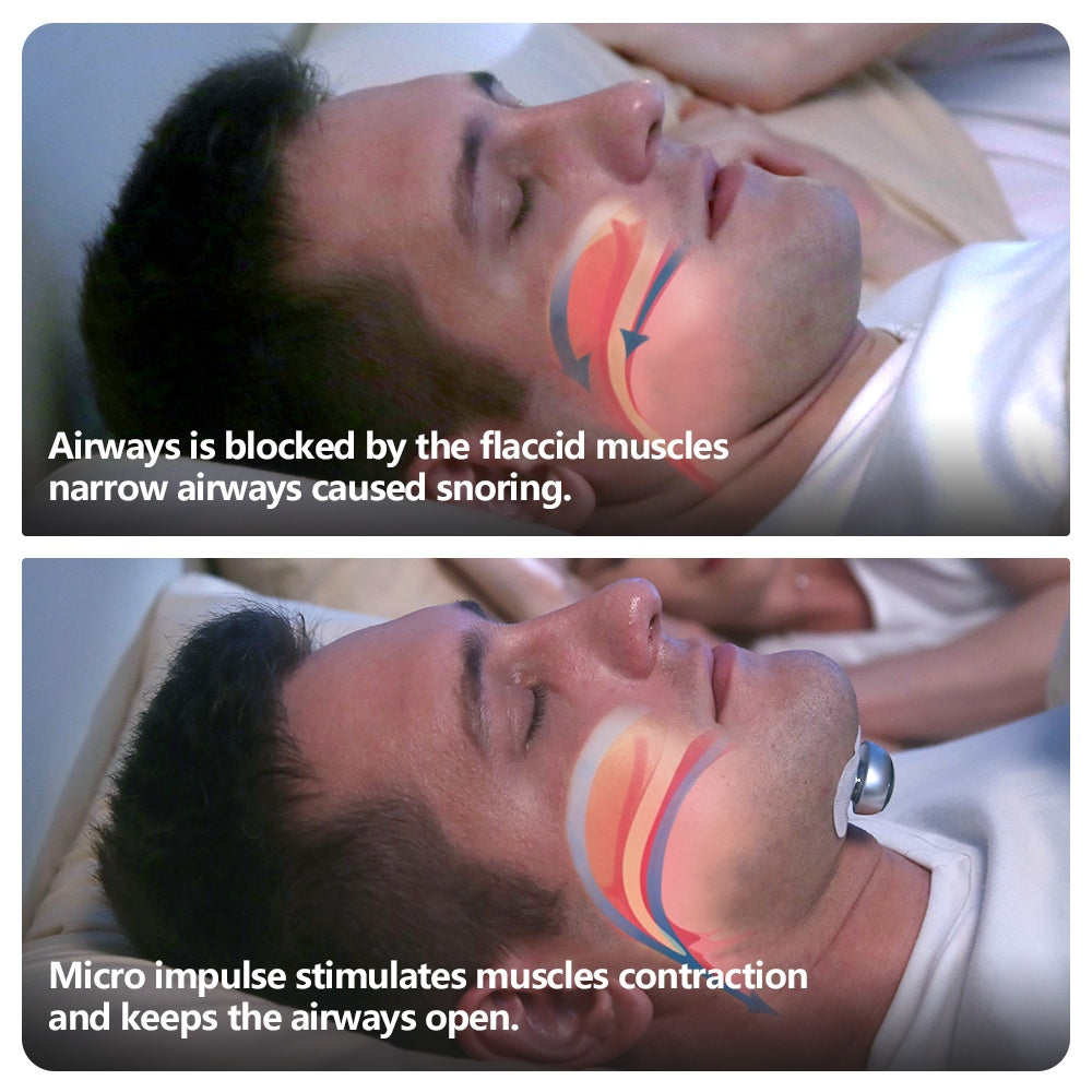 Smart Anti Snoring Device Electronic